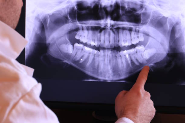 Best Emergency Dental Care for Abscessed Tooth in Ore City, TX