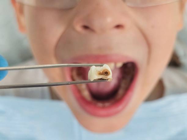 Best 24-Hour Emergency Dentist in Ore City, TX